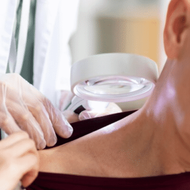 Tipos de cancer de piel