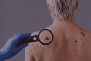 Dermatologia oncologica